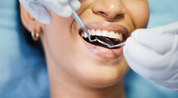 Best Chipped Tooth Repair Near Me  in Smithers, WV